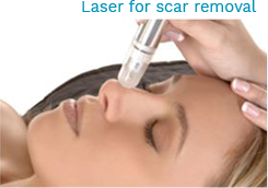 Laser Skin Treatment Chennai