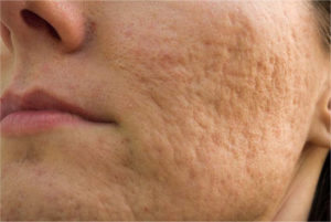 Close-up image of healthy, radiant skin texture from Helios Skin Clinic.