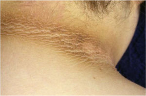 A woman's neck with a lot of skin on it.