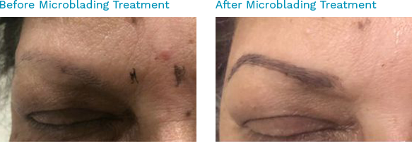 Before & After Microblading