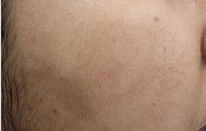 Skin Care Specialist in Chennai