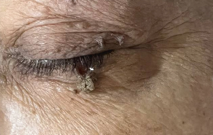 Best Skin Clinic in Alwarpet