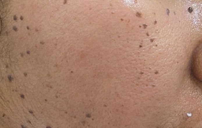 Skin Care Specialist in Chennai