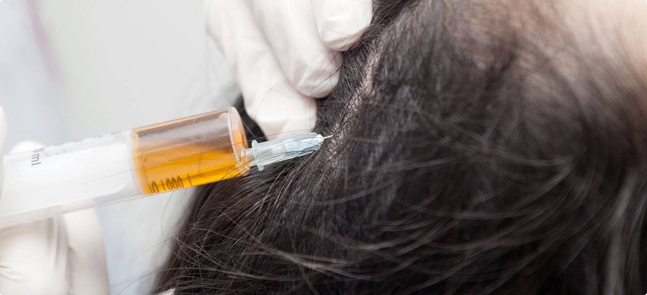 Laser Hair Removal Treatment Chennai