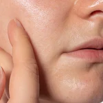 Cryotherapy Treatment in Chennai