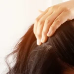 Dandruff Treatment in ECR