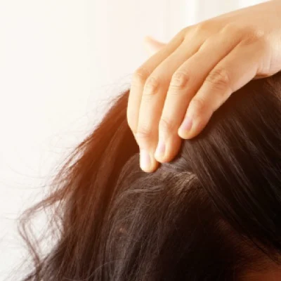 Dandruff Treatment in ECR