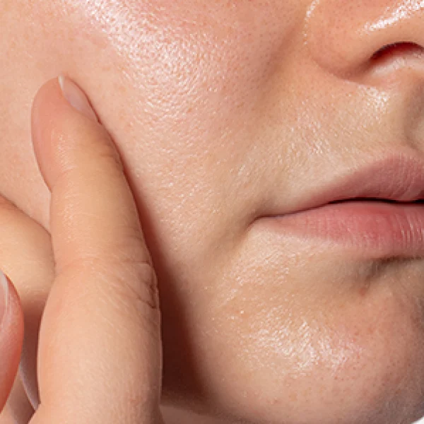 Cryotherapy Treatment in Chennai